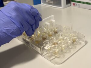 Allergy Skin Testing in Prosper